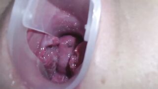 高清拍摄少女用扩阴器展示自己的阴道和宫颈