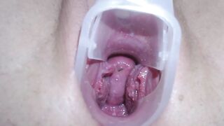 高清拍摄少女用扩阴器展示自己的阴道和宫颈