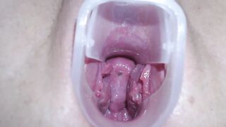 高清拍摄少女用扩阴器展示自己的阴道和宫颈