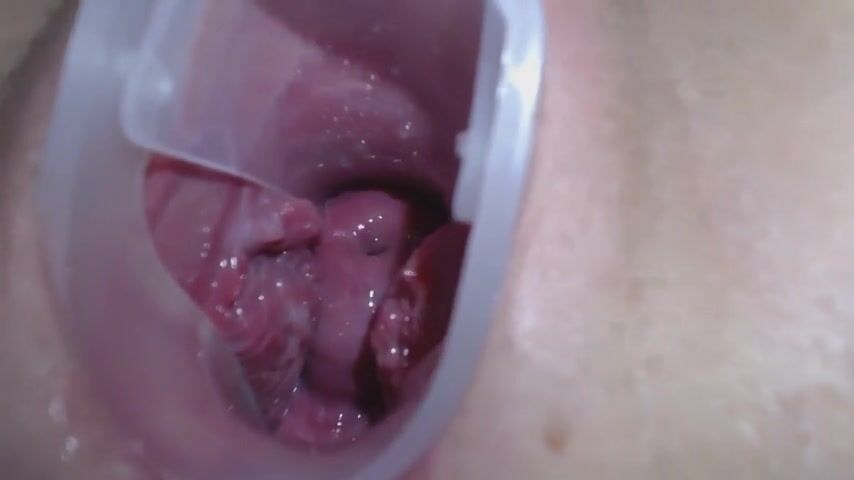 高清拍摄少女用扩阴器展示自己的阴道和宫颈